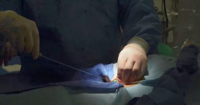 CSS beneficia a pacientes renales con jornadas extraordinarias de catéteres en Ciudad de la Salud CSS beneficia a pacientes renales con jornadas extraordinarias de catéteres en Ciudad de la Salud