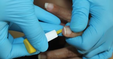 CSS promueve autocuidado frente a enfermedades de transmisión sexual CSS promueve autocuidado frente a enfermedades de transmisión sexual